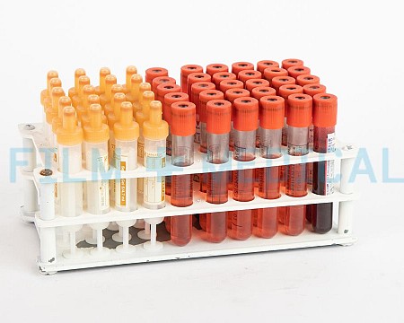 Vacutainers in Rack